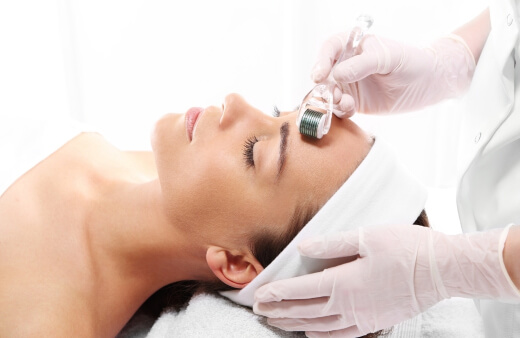 A-woman-undergoing-microneedling